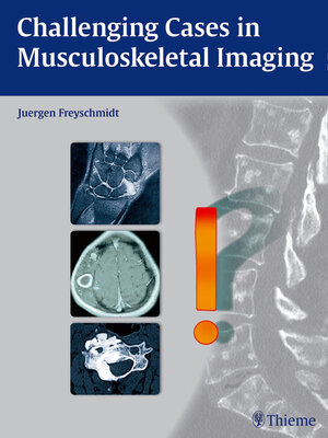 cover image of Challenging Cases in Musculoskeletal Imaging